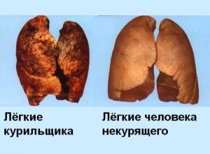 Zašto ne možete prestati pušiti - posljedice odvikavanja od nikotina